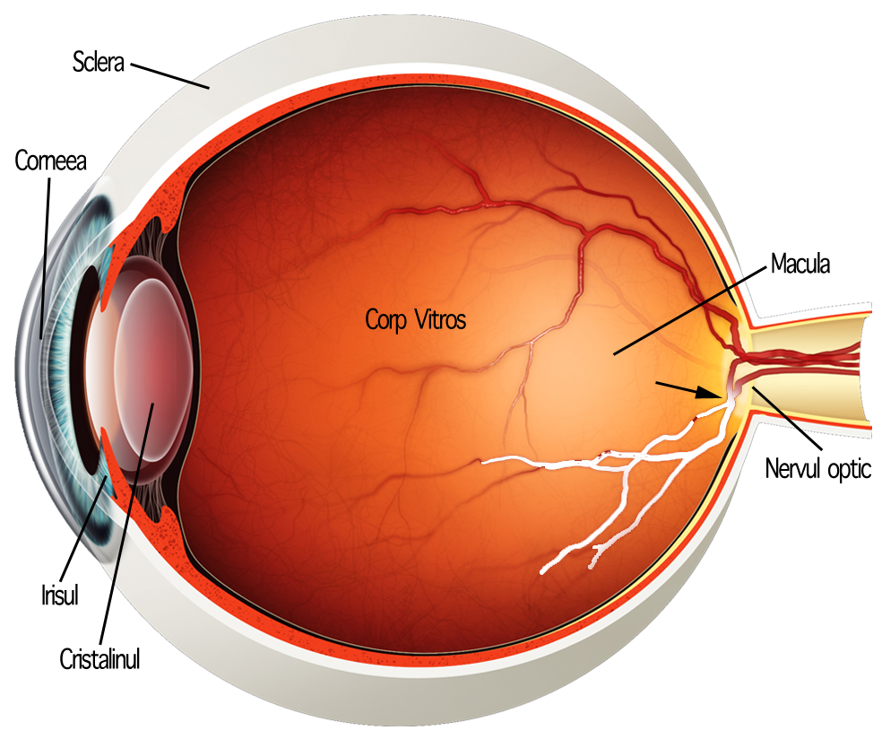 Tratamentul venelor oculare dilatate